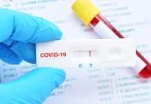 Covid-19 - alunos da área de saúde com formatura antecipada não serão obrigados a atuar na pandemia - ODEBATEON