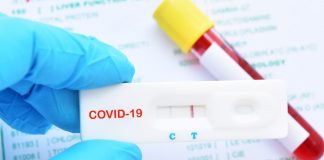 Covid-19 - alunos da área de saúde com formatura antecipada não serão obrigados a atuar na pandemia - ODEBATEON