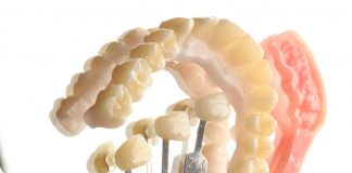 Odontologia digital traz agilidade para dentistas e pacientes - Foto reprodução -Implo (2)